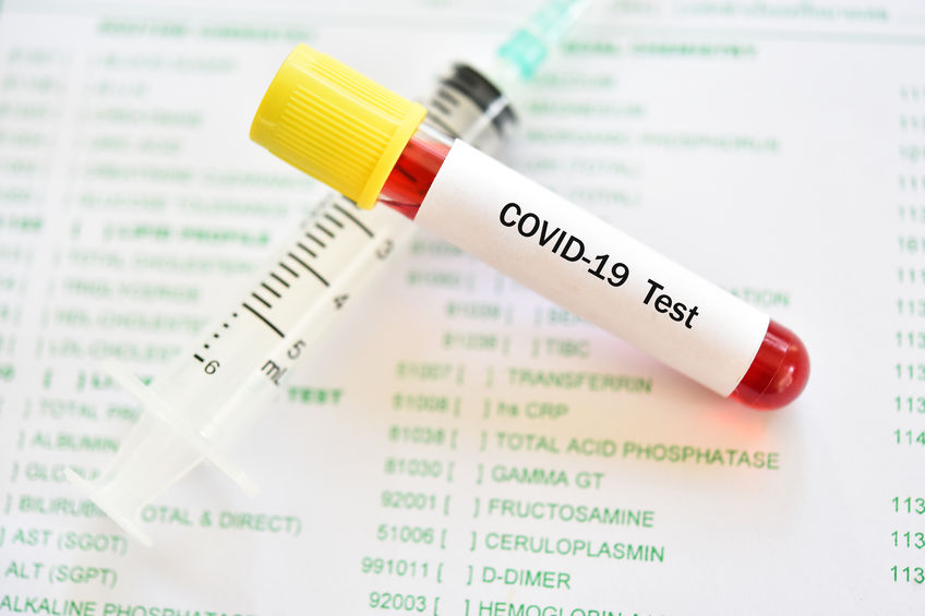 Test na przeciwciała koronawirusa