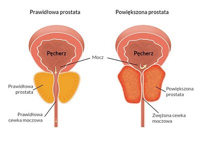 Rycina nr 1.