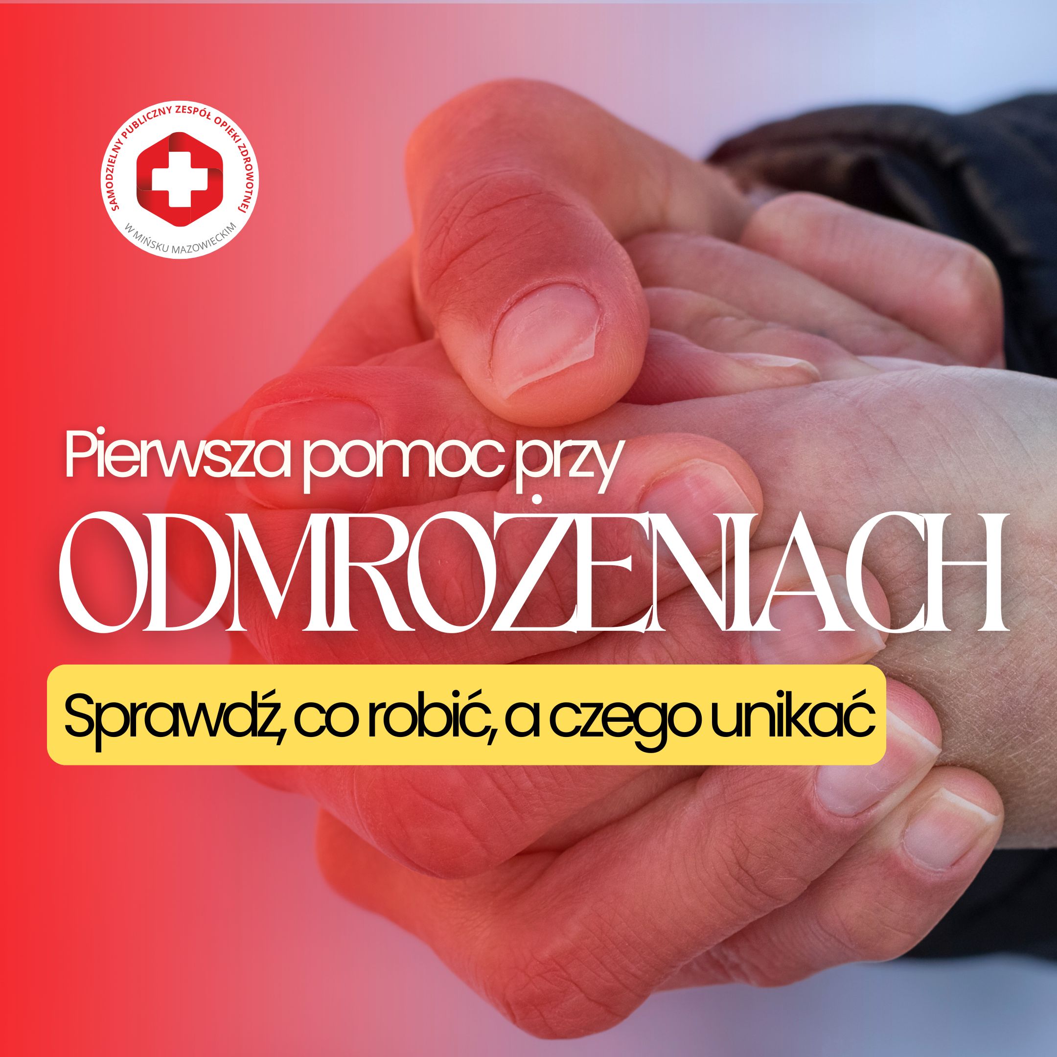 You are currently viewing Pierwsza pomoc przy odmrożeniach – sprawdź, co robić, a czego unikać