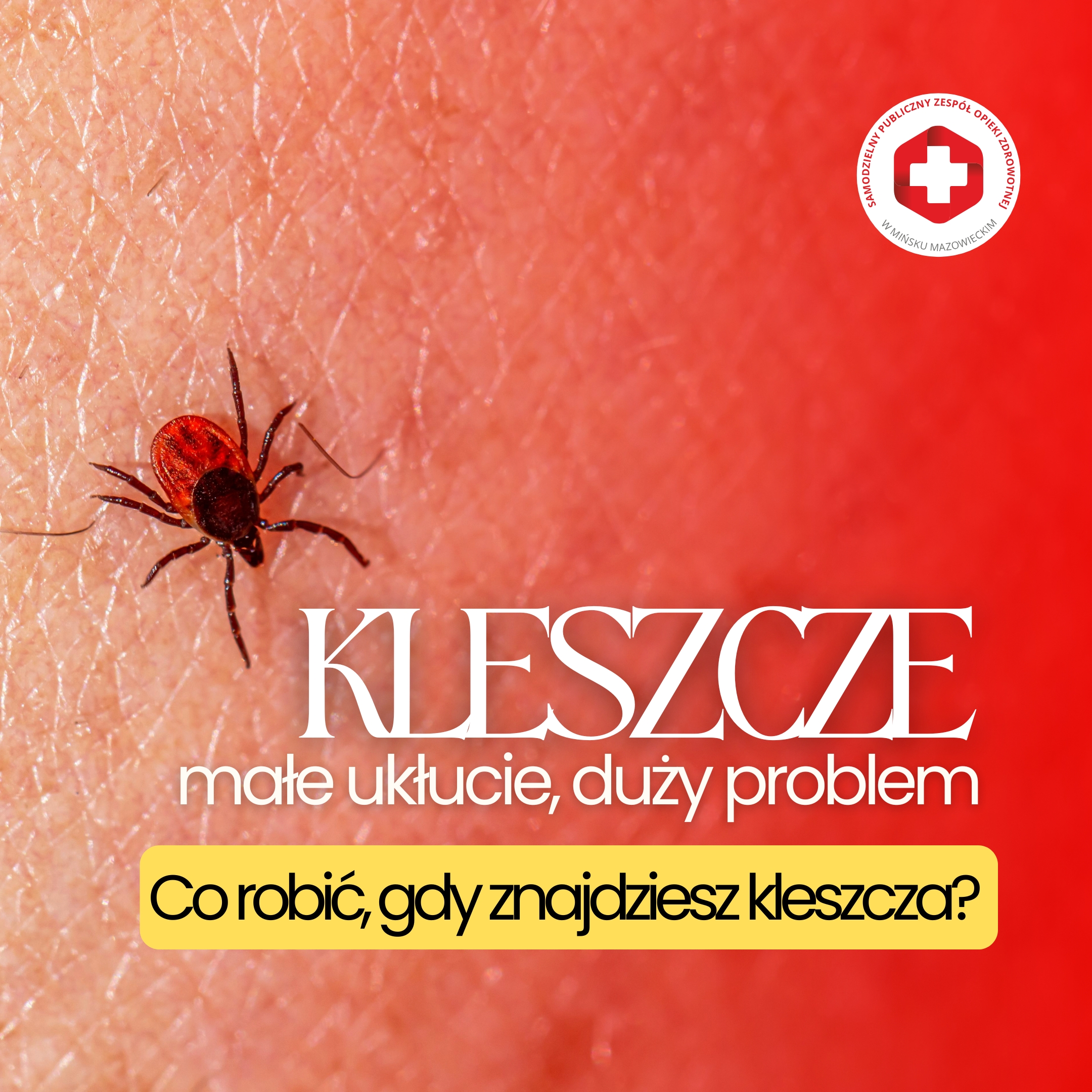 You are currently viewing KLESZCZE – małe ukłucie, duży problem. Co robić, gdy znajdziesz kleszcza?